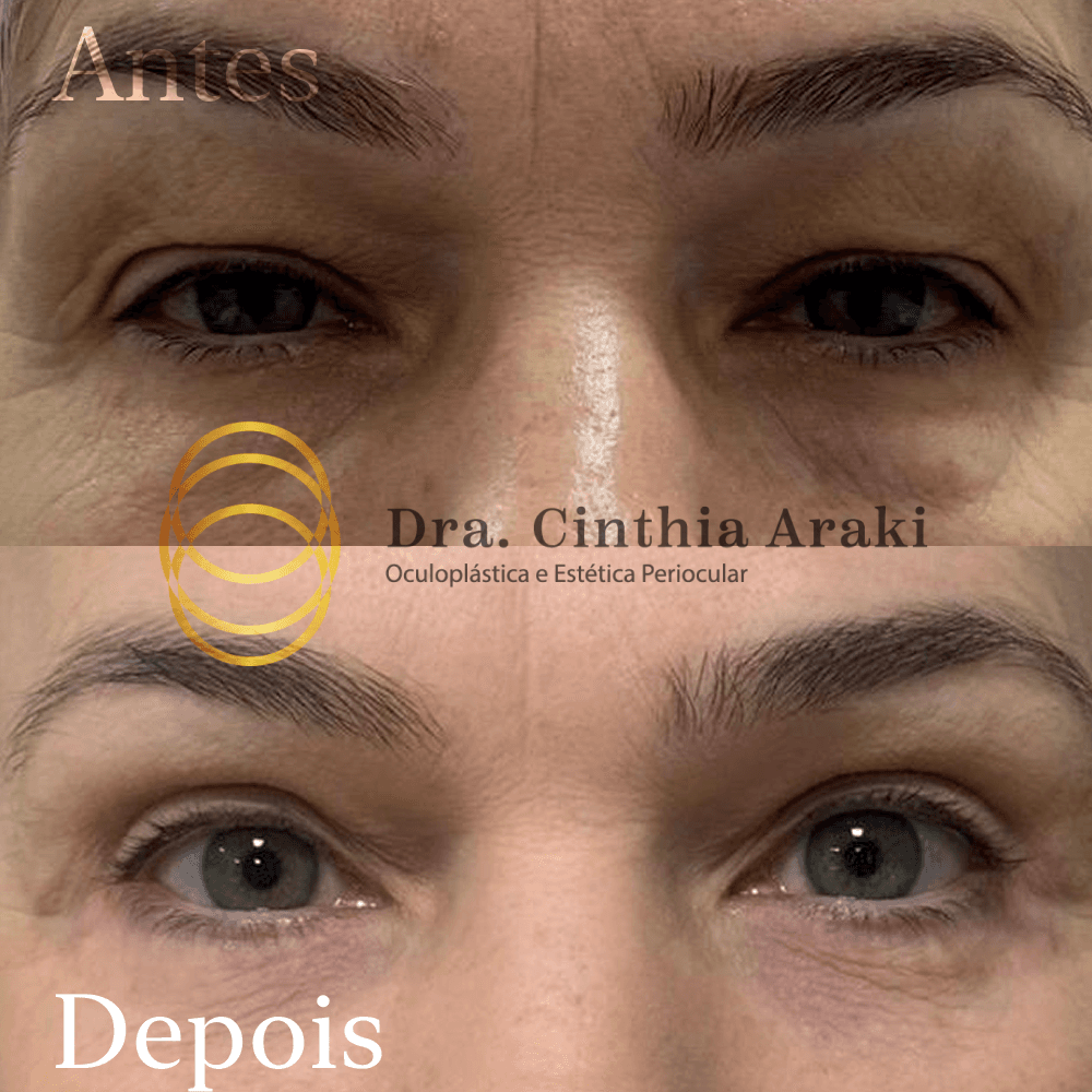 Antes e depois 7