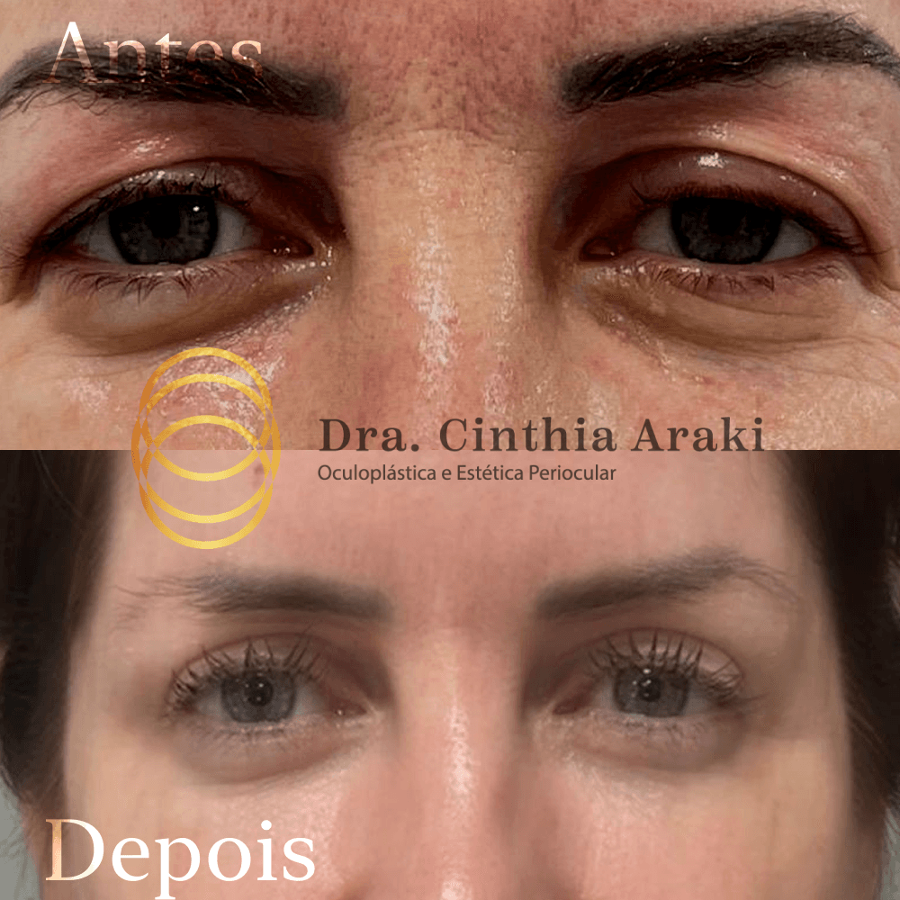 Antes e depois 8