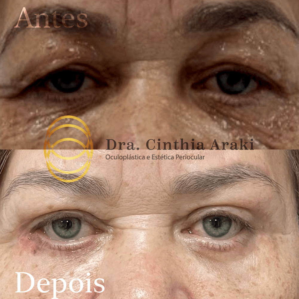 Antes e depois 12